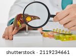 Small photo of Human liver disease, diagnosis and liver treatment. Doctor showing liver anatomical model for treatment hepatitis, cirrhosis and cancer