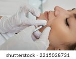 Small photo of Female face with mimic wrinkles near mouth, beautician doing injection into nasolabial folds. Botulinum toxin injection for remove wrinkle