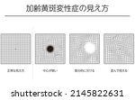 eye disease  age related... | Shutterstock .eps vector #2145822631