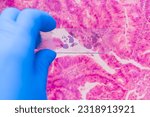 Small photo of Scientist in blue gloves hand holding glasses slide breast tissue on out of focus cancer tissue picture background.Pathologist hand in glove holding glass organ samples.Histological examination.