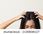Small photo of Young woman itchy head There is a fungus on the scalp dandruff, red rash She scratched her head to bring relief. Need to consult a doctor. Hair problems hair loss. Shot on isolated background