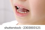 Small photo of Child shows his loose milk tooth presses and pushes it with his tongue. Open mouth close-up. Caucasian 6 year old kid in a white T-shirt on a bathroom background. lower incisor. Copy space. Body part.