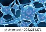 Parkinson's Disease  Neurons...