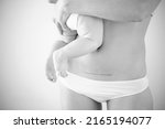 Small photo of black and white photo. Mom's abdomen after cesarean section. Scar seam. A young mother holds the baby in her arms. Real motherhood. Lifestyle. High quality photo