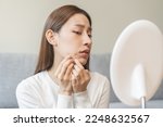 Small photo of Expression worry asian young woman hand touching pustule around the chin and mouth, allergic when wear mask, makeup, show squeezing pimple spot from face. Beauty care, skin problem by acne treatment.