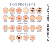 skin problems. set of icons for ... | Shutterstock .eps vector #2068014104
