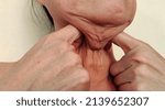 Small photo of portrait showing the fingers holding flabbiness adipose hanging skin under the neck, problem wrinkled cellulite under the chin of woman, problem health care.