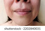 Small photo of portrait showing the flabbiness adipose sagging skin beside the mouth, Flabby corner of smile lines, problem wrinkles and dark spots on the face of the woman, concept health care.