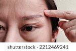 Small photo of portrait the flabbiness adipose sagging skin, cellulite and swelling under the eyes, ptosis corner the eyelid, problem wrinkles and flabby skin, forehead lines of the woman, concept health care.