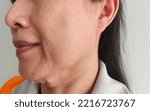 Small photo of portrait the flabbiness adipose sagging skin, cellulite and flabby skin under the neck, smile lines beside the mouth, problem wrinkles and dark spots on the face of woman's, health care concept.