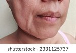 Small photo of close up the flabbiness and wrinkle beside the mouth, Flabby skin, dark spots and rough skin, blemish, the mouth dry skin, freckles and pore on the face of the woman, health care and beauty concept.