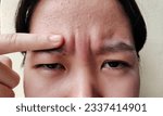 Small photo of portrait the flabbiness and wrinkle, forehead lines and flabby skin, angry and emotion on the face of the woman, health care and beauty concept.