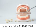 Small photo of Teeth model with dental plaque tool ,Concept Dental care cleaning bacterial plaque and scaling tartar