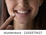 Small photo of Happy girl showing toothy smile, pointing finger at healthy white teeth. Clinic patient satisfied with dentist service, enamel cleaning, whitening, dental care, correction. Cropped shot, close up