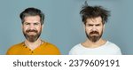 Small photo of Man hair loss and problem hair. Hairs problems. Sad and happy. Haircare and loss hair problem. Tangling hairs. Combing damaged hairs. Beard and mustache. Hairstyle, hair stylist. Male beauty.