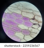 Small photo of Epidermal cells of Rhoeo leaf under the light microscope