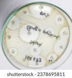 Small photo of Antimicrobial susceptibility testing in culture plate. Drug sensitivity test, disk drug, antibiotic sensitivity, Cefixime resistance.