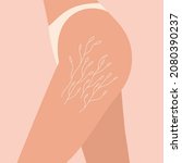woman hips with stretch marks... | Shutterstock .eps vector #2080390237