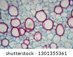 Small photo of Microscope photo of a sambucus stem with parenchyma cells.