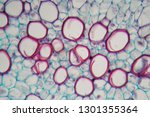 Small photo of Microscope photo of a sambucus stem with parenchyma cells.