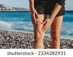 Small photo of A jellyfish sting burn on a man's leg, on the beach