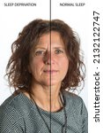 Small photo of Effects of sleep deprivation on a woman's face, comparison before and after sleep deprivation and normal rest