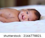 Small photo of She wont let her birth defect get her down. Portrait of a baby girl with a cleft palate lying on a bed.