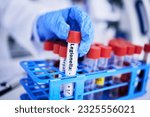 Small photo of Scientist, hand and bacteria sample in test tube, person in lab with medical research and healthcare study. Doctor, gloves and vaccine, check legionella sample closeup and scientific experiment