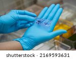 Small photo of Medical scientists are preparing cytology specimens to detect abnormalities from a woman's cervix.