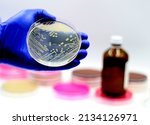 Small photo of microbial culture of Staphylococcus aureus in the microbiology laboratory