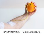 Small photo of Transfusion of vitamin C from an orange to an arm. Concept on the benefits of vitamin C fruit intake.