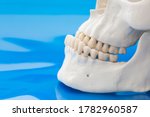 Small photo of Model of prognathism. Jawbones with maxillary and mandibular dentition and protrusion of lower jaw on blue background