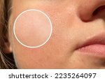 Small photo of Two pictures compared effect Before and After treatment. Skin with problems of pore , dull skin and wrinkles before and after treatment to solve skin problem for better skin result