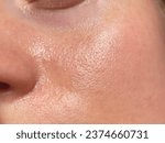 Small photo of Macro photo of big pore on oily facial skin type. Skin with enlarged pores. Care for problem skin. Sun, natural light