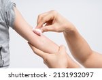 Mother hand holding cotton wool soaked anti skin allergy cream medicine for healing itchy symptom on her child arm