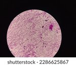 Small photo of Gram negative bacilli under light microscope ( 40X)