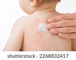 Small photo of Mother fingers applying white medical ointment on infant bare back isolated on light gray background. Red rash on skin. Allergy from food, milk formula or mother milk. Care about baby body. Closeup.