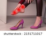 Small photo of Woman suffering from leg pain in office. She rubbed terrible calluses from uncomfortable high-heeled shoes