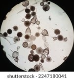 Small photo of Microscopic skeleton of protozoan Radiolaria. Radiolarians, also called Radiozoa. protozoa. mineral skeletons. zooplankton under microscope.