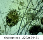 Small photo of This is a picture of the parasite that causes scabies, namely Sarcoptes scabiei