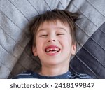 Small photo of Laughing kid shows hole in row of teeth in his mouth. One incisor fell out just now. Close up photo of gums for dentist.