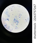 Small photo of Mycobacterium. Acid-fast bacilli stain technique.