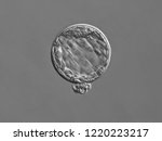 Small photo of Photomicrograph of an isolated blastocyst stage human embryo, 20x magnification. Embryogenesis. Research. Genes. Life.