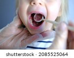 Small photo of dentist, doctor examines oral cavity of small patient, uses mouth mirror, closeup baby teeth child, concept pediatric dentistry, dental treatment, correction of occlusion, oral care, caries prevention