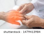 Small photo of Peripheral Neuropathy concept. Doctor neurologist checkup old patient for symptoms of numbness, prickling or tingling in hands