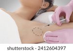 Small photo of The doctor makes intramuscular injections of botulinum toxin in the underarm area against hyperhidrosis.