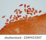 Small photo of Fluke(Parasitic flatworm) of cattle and other grazing animals.