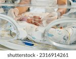 Small photo of Photo of a premature baby in incubator.Nurse in gloves is using the feeding tube for feeding premature baby. Focus on tube. Neonatal intensive care unit