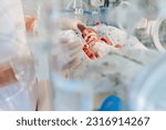 Small photo of Unrecognizable hand in gloves of nurse or doctor taking care of premature baby placed in a medical incubator. Neonatal intensive care unit in hospital.