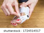 Small photo of Woman uses a special medical splint or orthopedic bandage to treat and prevent painful Hallux Valgus. Bunion on big toes of female feet.